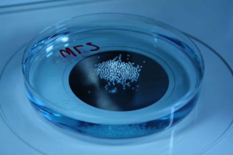 Cohesin proteins and human development