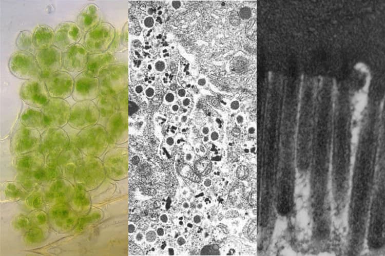 Cell organelles