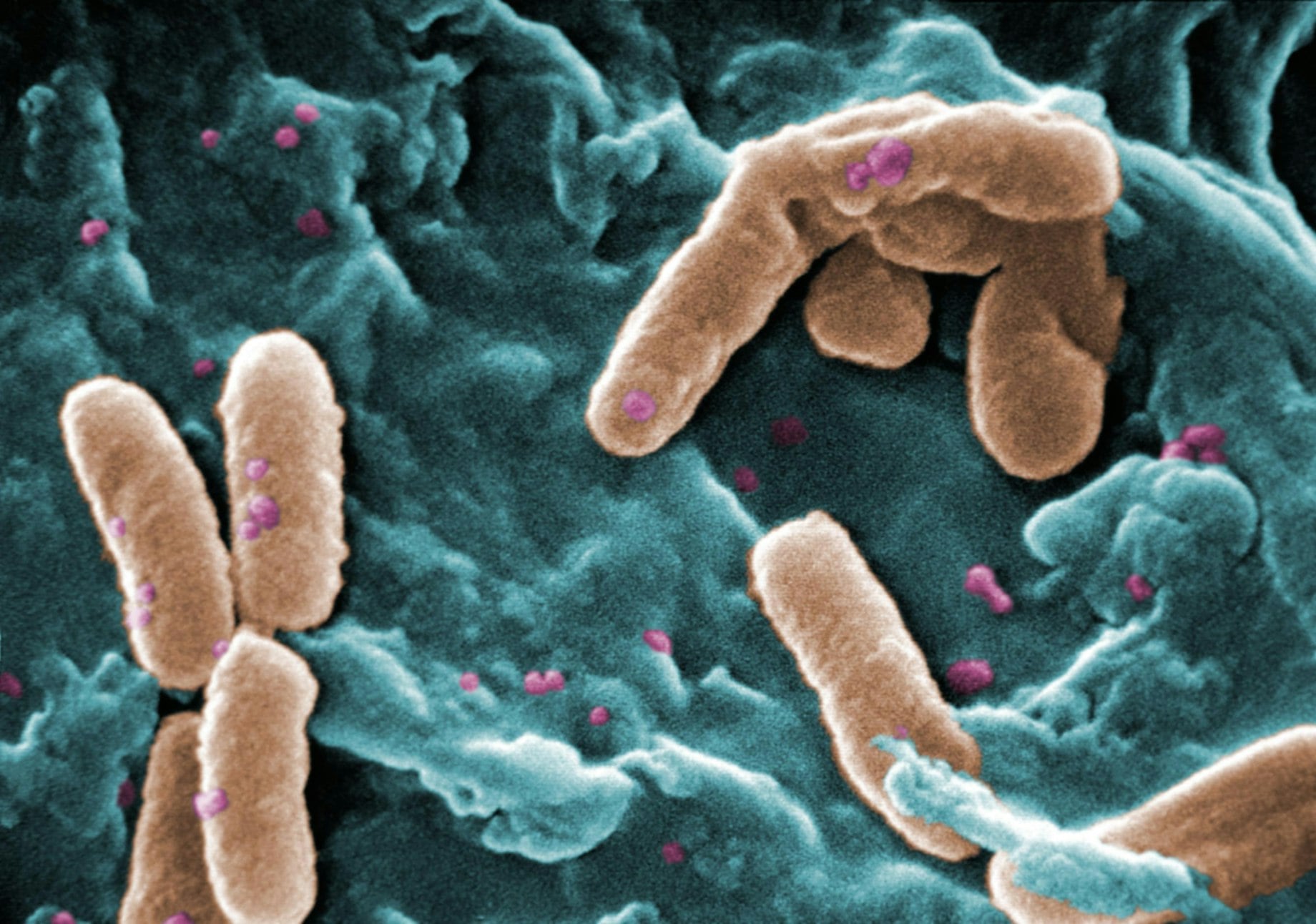 Coloured view of Pseudomonas bacteria under a microscope.