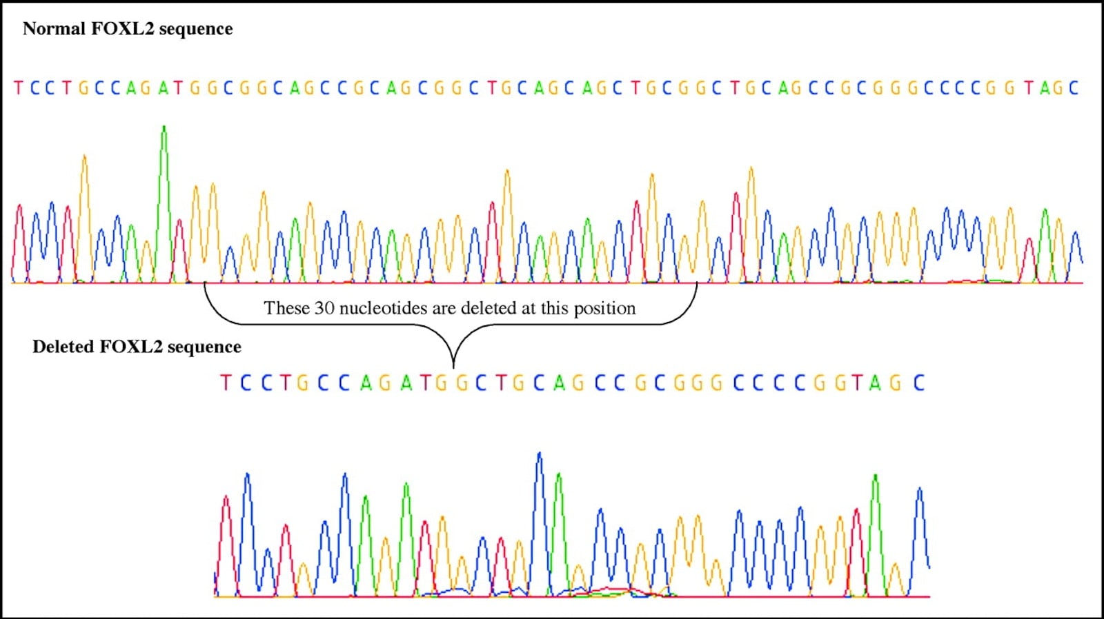 DNA sequencing results to find gene variations.