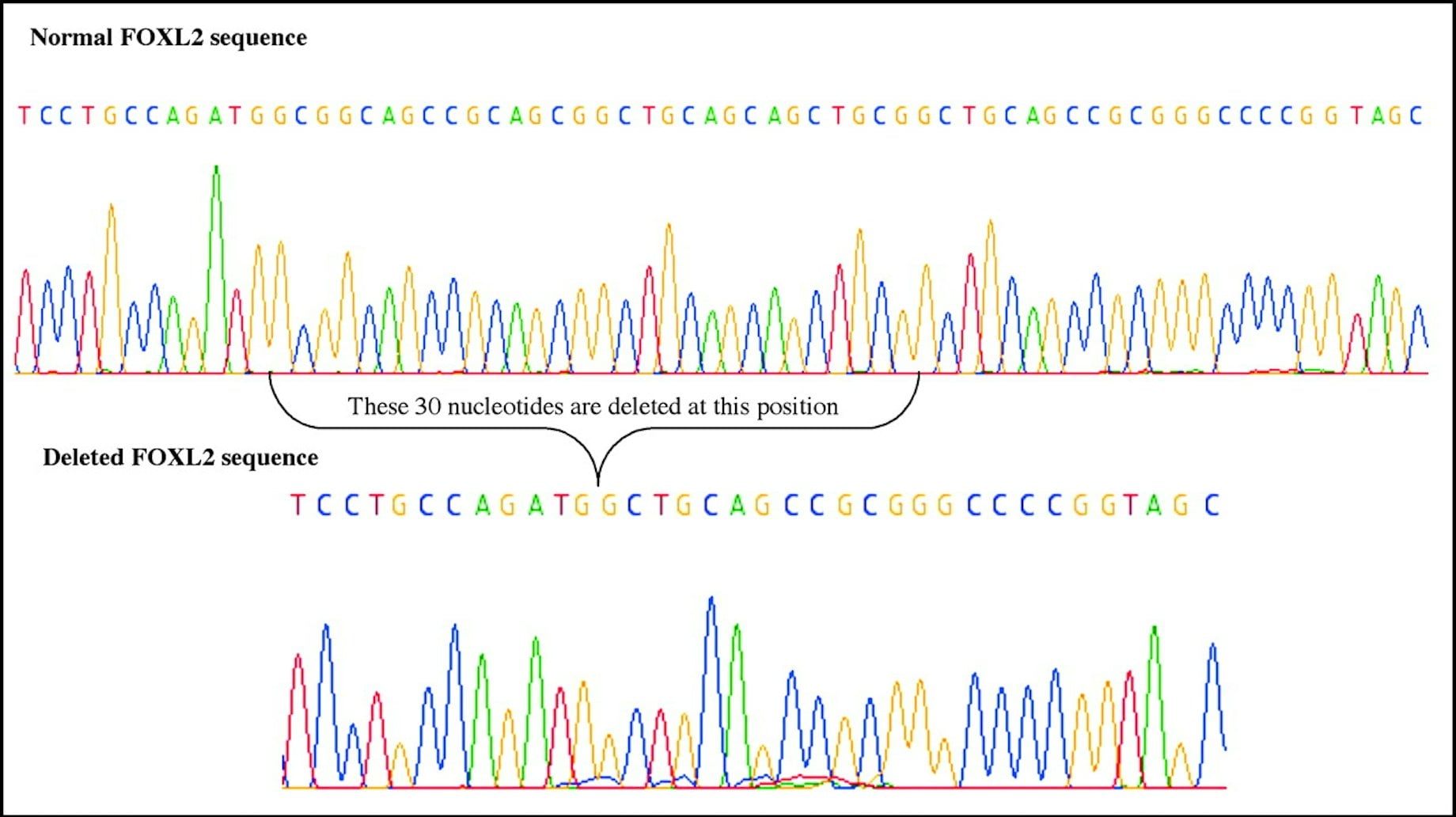 DNA sequencing results to find gene variations.